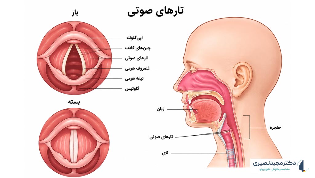 Taar soti