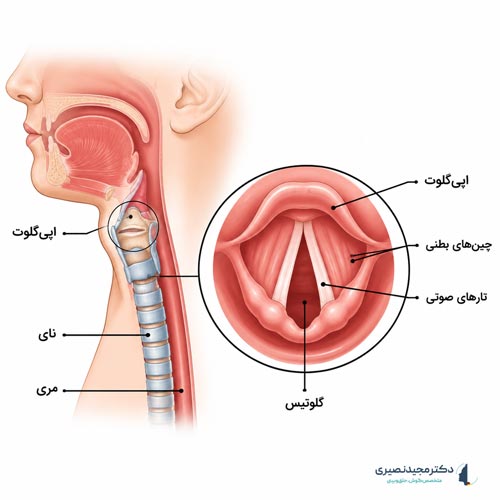 پولیپ تارهای صوتی