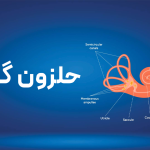 حلزون گوش