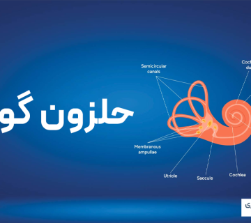 حلزون گوش