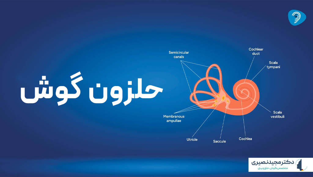 حلزون گوش